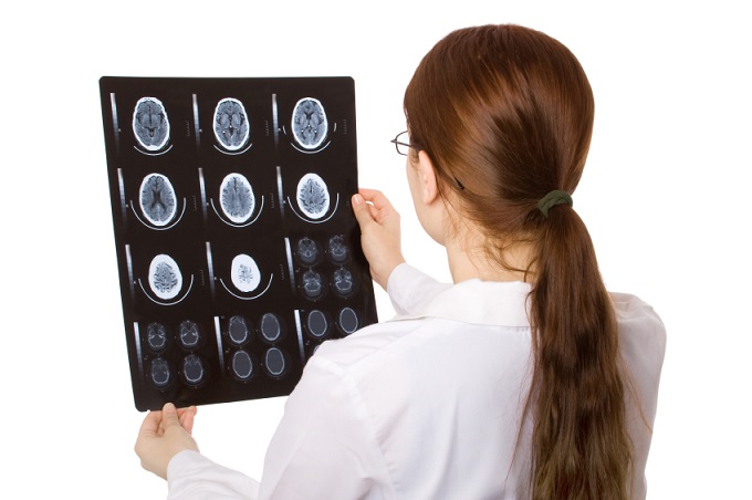 Brain scan