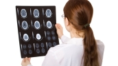 Brain scan
