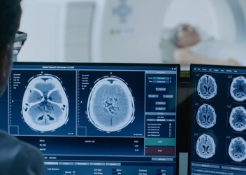 Traumatic Brain Injury NASEM